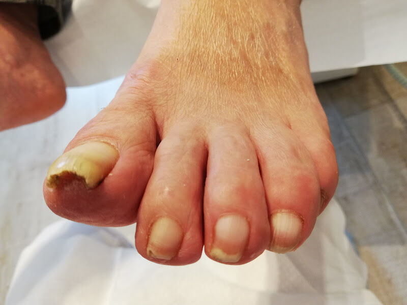 Foto van Gespecialiseerd voetverzorger medische pedicure.